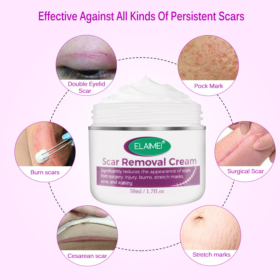 Skin  Scarless Cream Skin Repair Strech Mark Recover X  With Cayman Peptide