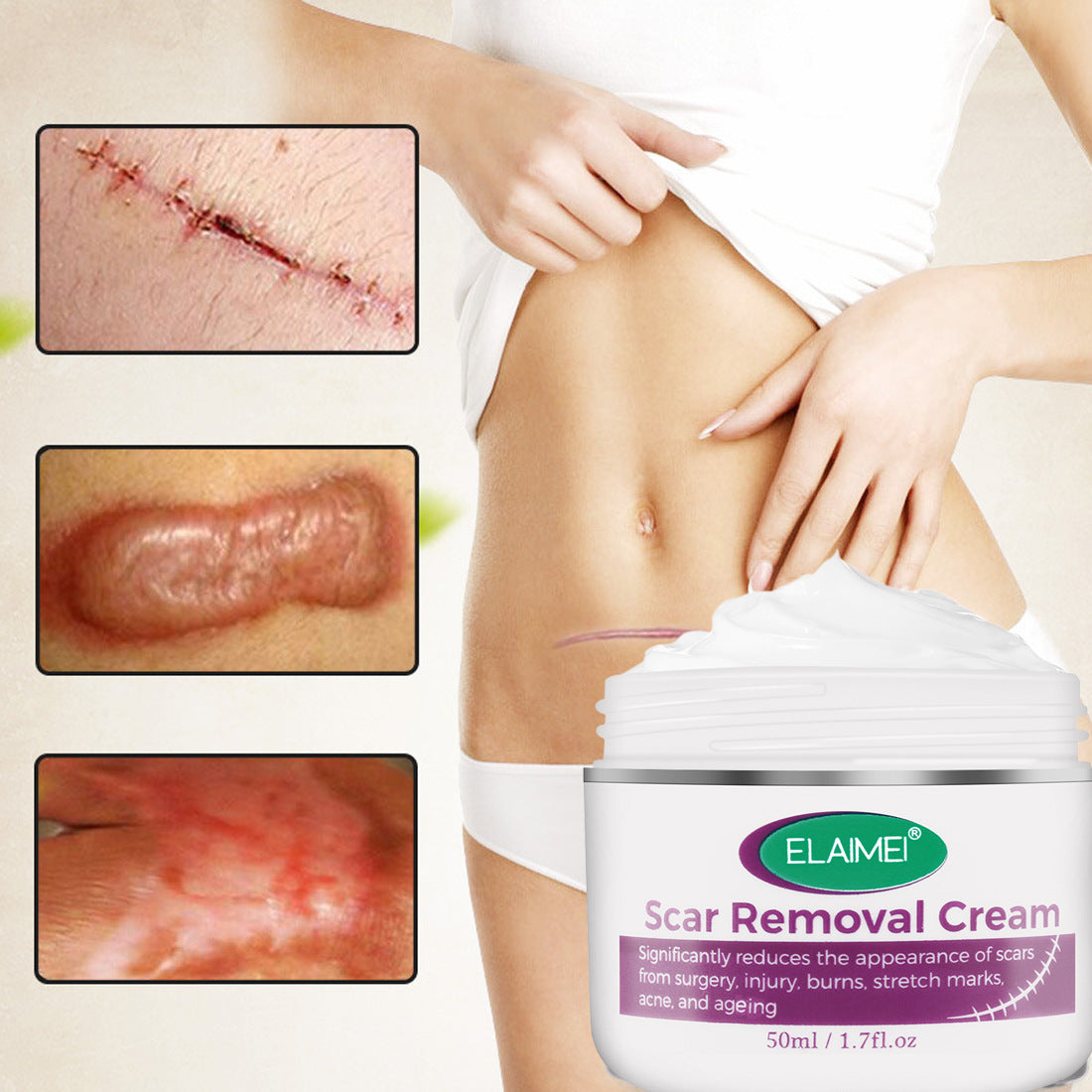 Skin  Scarless Cream Skin Repair Strech Mark Recover X  With Cayman Peptide