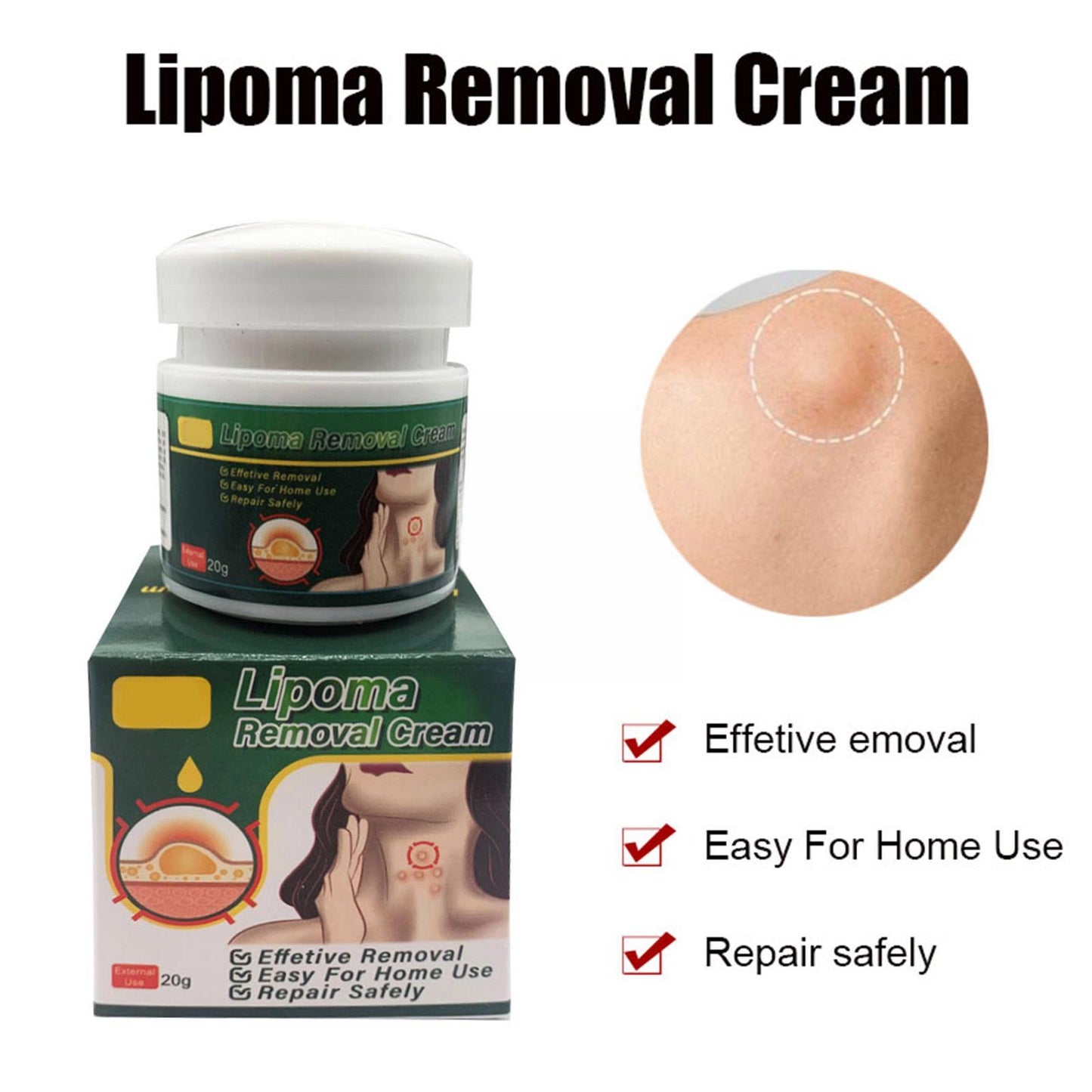 4 bottles LIPOMA REMOVAL CREAM- Treat Tumor Skin Swelling Ointment Exfoliating Pain Relief Body Health