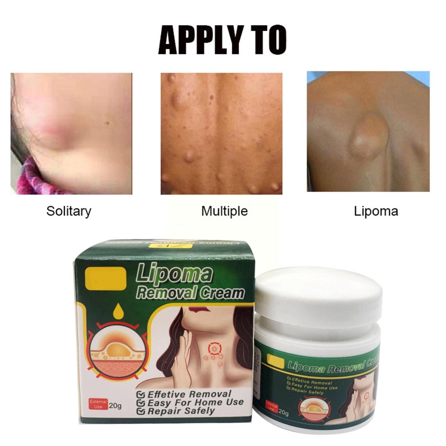 4 bottles LIPOMA REMOVAL CREAM- Treat Tumor Skin Swelling Ointment Exfoliating Pain Relief Body Health