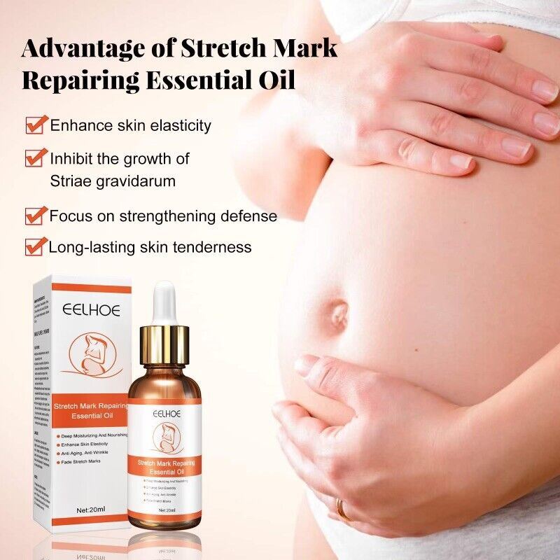 Stretch Marks Remover Essential Oil Skin Care Treatment Cream For Scar Care